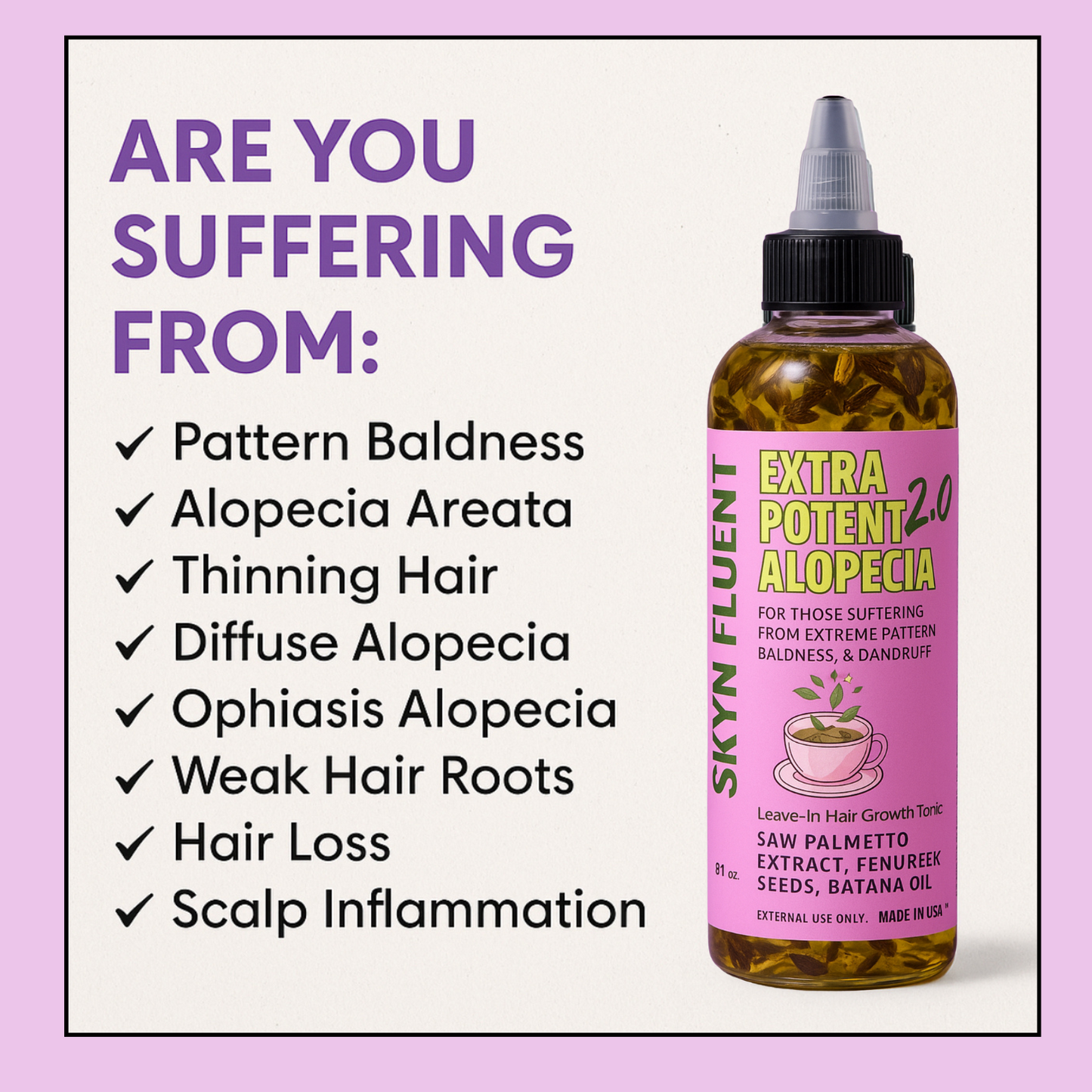 Alopecia Hair Growth Tonic – For Thinning Edges & Bald Spots