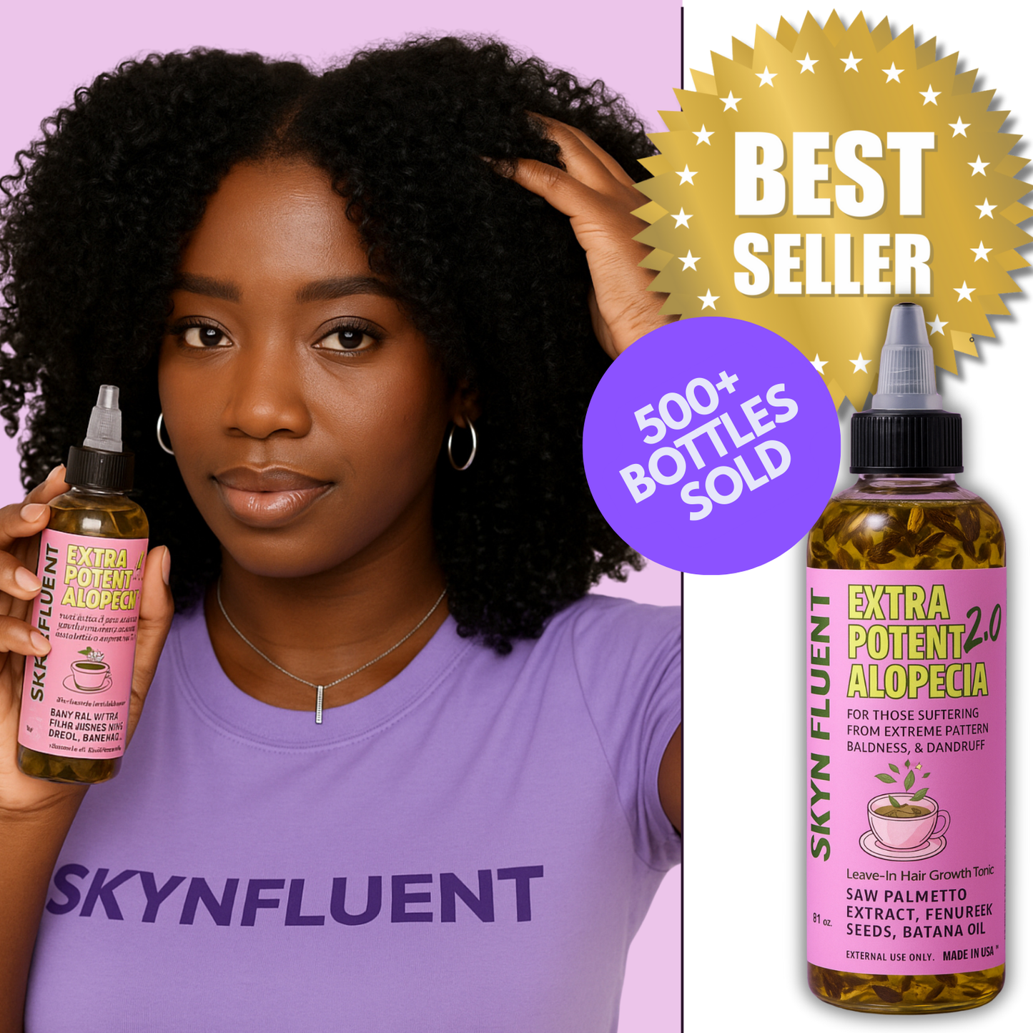 Alopecia Hair Growth Tonic – For Thinning Edges & Bald Spots